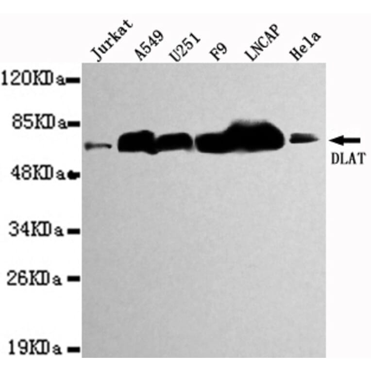 Western blot - DLAT Monoclonal Antibody from Signalway Antibody (27119) - Antibodies.com