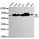 Western blot - DLAT Monoclonal Antibody from Signalway Antibody (27119) - Antibodies.com