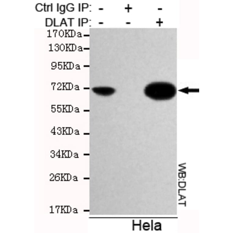 Immunoprecipitation - DLAT Monoclonal Antibody from Signalway Antibody (27119) - Antibodies.com