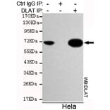 Immunoprecipitation - DLAT Monoclonal Antibody from Signalway Antibody (27119) - Antibodies.com