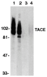 Western blot - TACE Antibody from Signalway Antibody (24018) - Antibodies.com