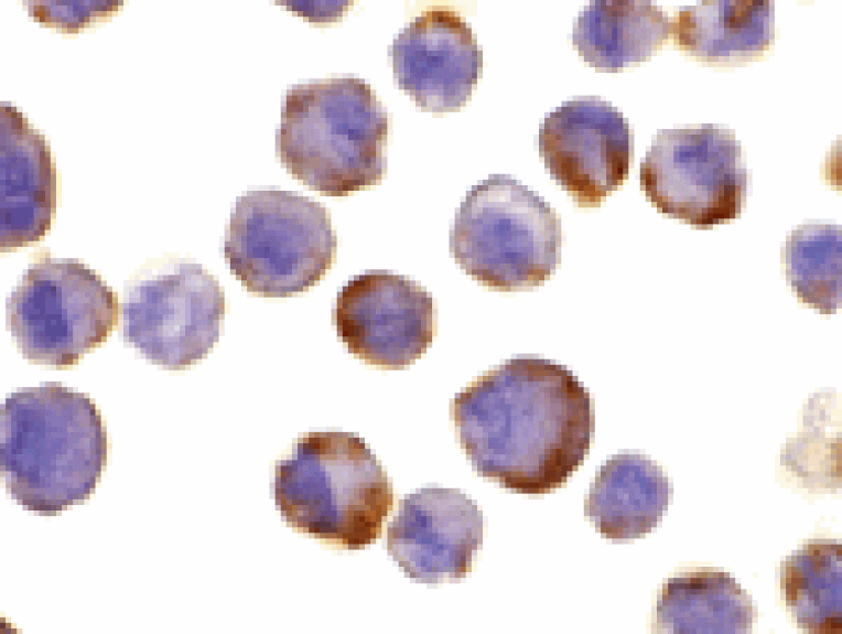 Immunocytochemistry - TACE Antibody from Signalway Antibody (24018) - Antibodies.com