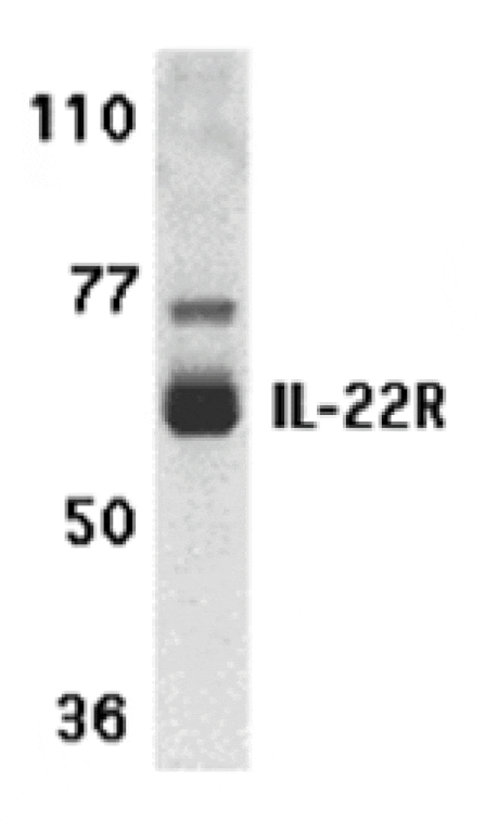 Western blot - IL-22 Receptor Antibody from Signalway Antibody (24153) - Antibodies.com