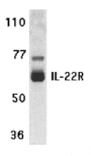 Western blot - IL-22 Receptor Antibody from Signalway Antibody (24153) - Antibodies.com