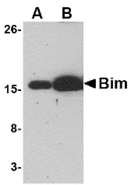Western blot - Bim Monoclonal Antibody from Signalway Antibody (26024) - Antibodies.com