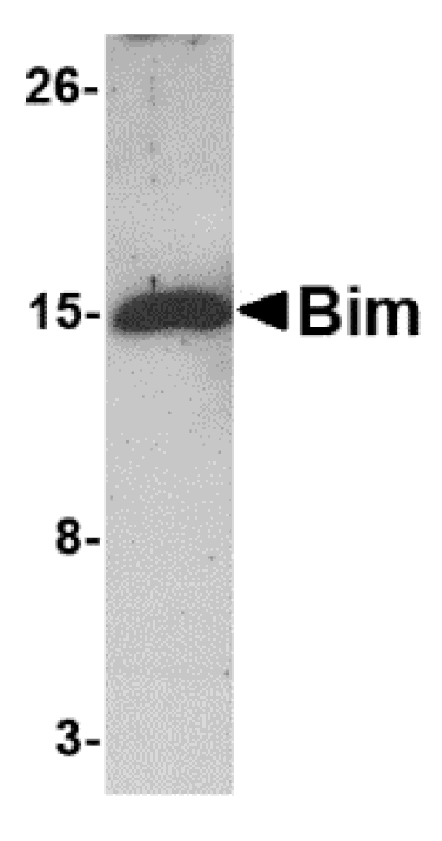 Western blot - Bim Monoclonal Antibody from Signalway Antibody (26025) - Antibodies.com