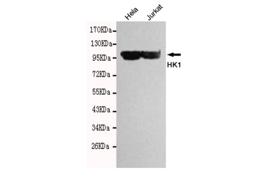Western blot - HK1 Monoclonal Antibody from Signalway Antibody (27098) - Antibodies.com