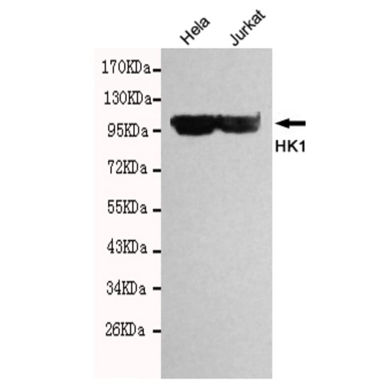 Western blot - HK1 Monoclonal Antibody from Signalway Antibody (27098) - Antibodies.com