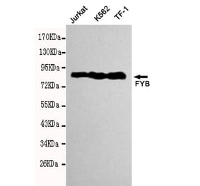 Western blot - FYB Monoclonal Antibody from Signalway Antibody (27114) - Antibodies.com
