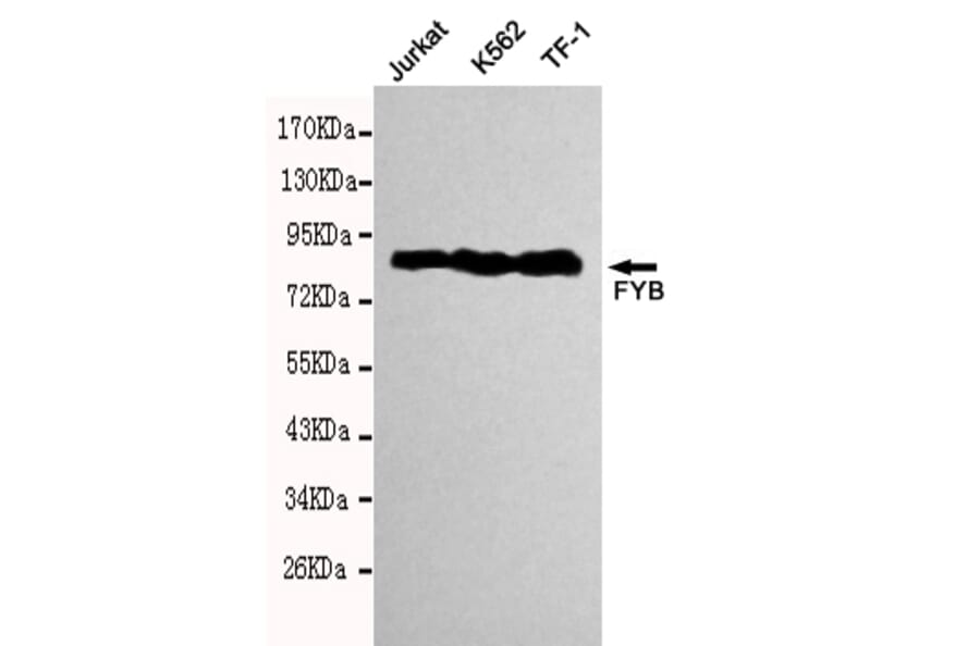 Western blot - FYB Monoclonal Antibody from Signalway Antibody (27114) - Antibodies.com