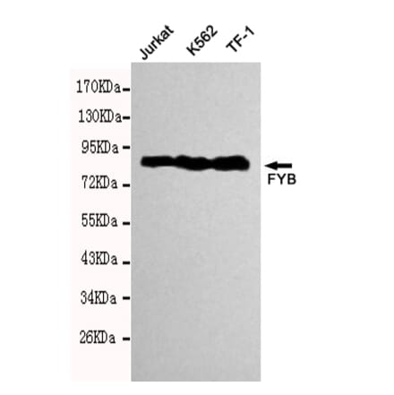 Western blot - FYB Monoclonal Antibody from Signalway Antibody (27114) - Antibodies.com