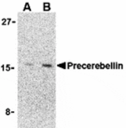 Western blot - Precerebellin Antibody from Signalway Antibody (24339) - Antibodies.com