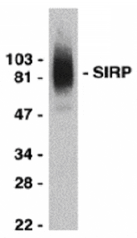 Western blot - SIRP alpha Antibody from Signalway Antibody (24015) - Antibodies.com