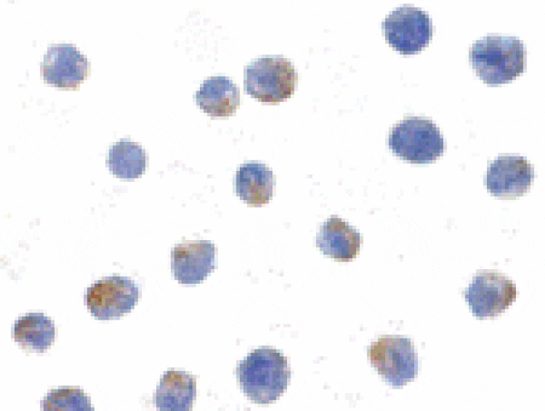 Immunocytochemistry - IKK alpha Antibody from Signalway Antibody (24043) - Antibodies.com
