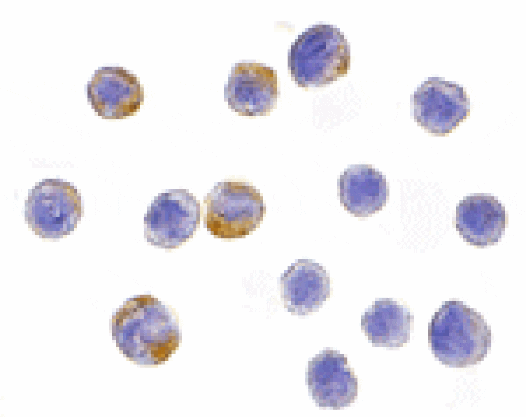 Immunocytochemistry - IKK alpha Antibody from Signalway Antibody (24061) - Antibodies.com