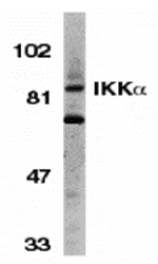 Western blot - IKK alpha Antibody from Signalway Antibody (24062) - Antibodies.com