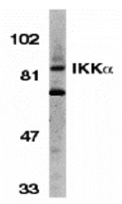 Western blot - IKK alpha Antibody from Signalway Antibody (24062) - Antibodies.com