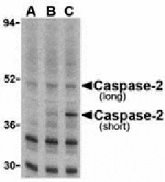 Western blot - Caspase-2 Antibody from Signalway Antibody (24285) - Antibodies.com