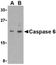 Western blot - Caspase-6 Antibody from Signalway Antibody (24294) - Antibodies.com