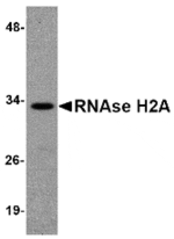 Western blot - RNAse H2A Antibody from Signalway Antibody (24819) - Antibodies.com