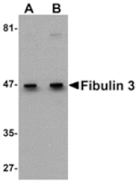 Western blot - Fibulin 3 Antibody from Signalway Antibody (24909) - Antibodies.com