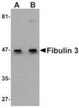 Western blot - Fibulin 3 Antibody from Signalway Antibody (24909) - Antibodies.com