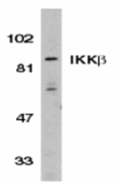 Western blot - IKK beta Antibody from Signalway Antibody (24063) - Antibodies.com