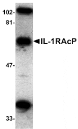 Western blot - IL-1RAcP Antibody from Signalway Antibody (24068) - Antibodies.com