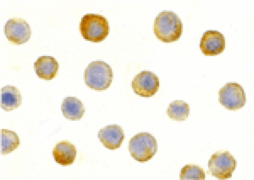Immunocytochemistry - IL-1RAcP Antibody from Signalway Antibody (24068) - Antibodies.com
