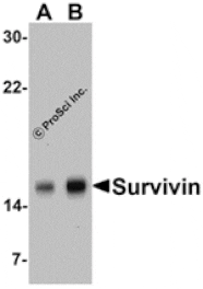 Western blot - Survivin Antibody from Signalway Antibody (24092) - Antibodies.com
