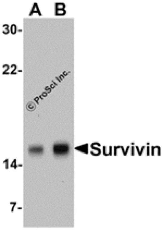 Western blot - Survivin Antibody from Signalway Antibody (24092) - Antibodies.com