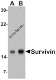Western blot - Survivin Antibody from Signalway Antibody (24092) - Antibodies.com