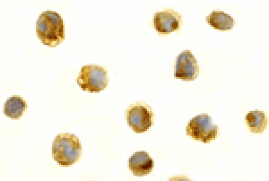 Immunocytochemistry - Survivin Antibody from Signalway Antibody (24092) - Antibodies.com