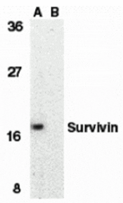 Western blot - Survivin Antibody from Signalway Antibody (24093) - Antibodies.com