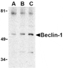 Western blot - Beclin-1 Antibody from Signalway Antibody (24351) - Antibodies.com