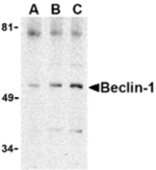 Western blot - Beclin-1 Antibody from Signalway Antibody (24351) - Antibodies.com