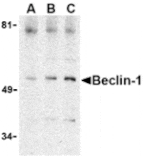 Western blot - Beclin-1 Antibody from Signalway Antibody (24351) - Antibodies.com