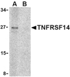 Western blot - TNFRSF14 Antibody from Signalway Antibody (24402) - Antibodies.com