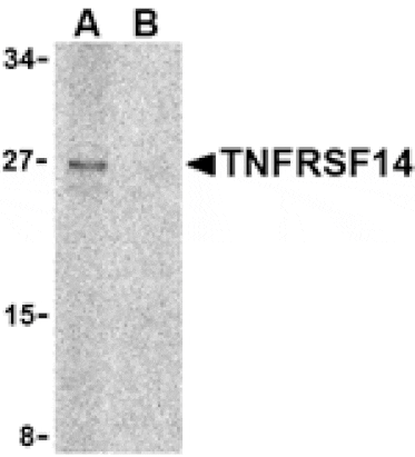 Western blot - TNFRSF14 Antibody from Signalway Antibody (24402) - Antibodies.com