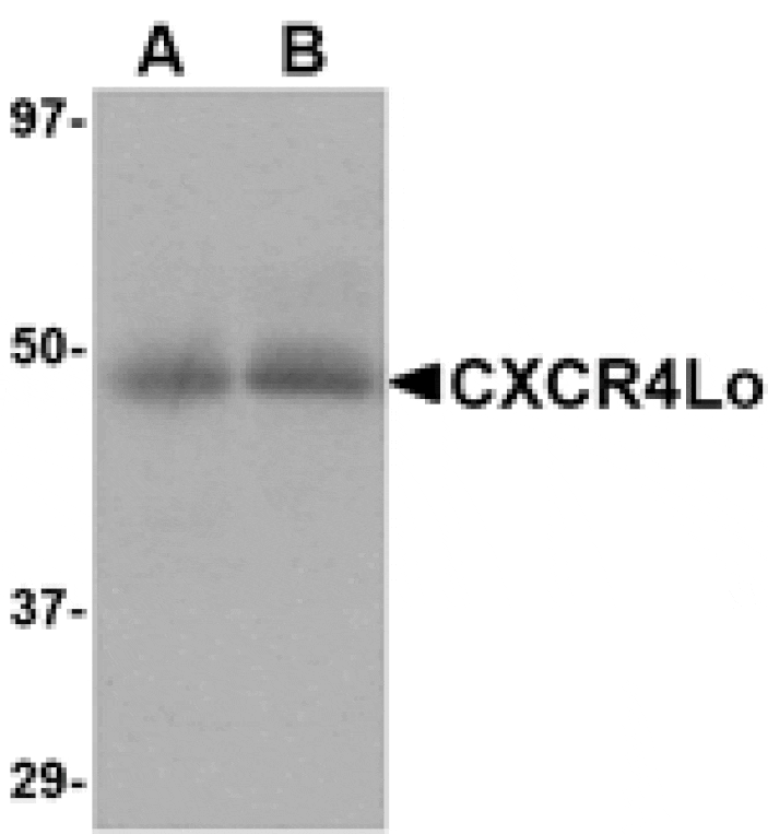 Western blot - CXCR4-Lo Antibody from Signalway Antibody (24624) - Antibodies.com