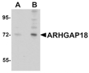 Western blot - ARHGAP18 Antibody from Signalway Antibody (25047) - Antibodies.com