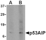 Western blot - p53AIP1 Antibody from Signalway Antibody (24141) - Antibodies.com