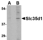 Western blot analysis of Slc35D1 in Daudi lysate with Slc35D1 antibody at (A) 1 and (B) 2 µg/mL.