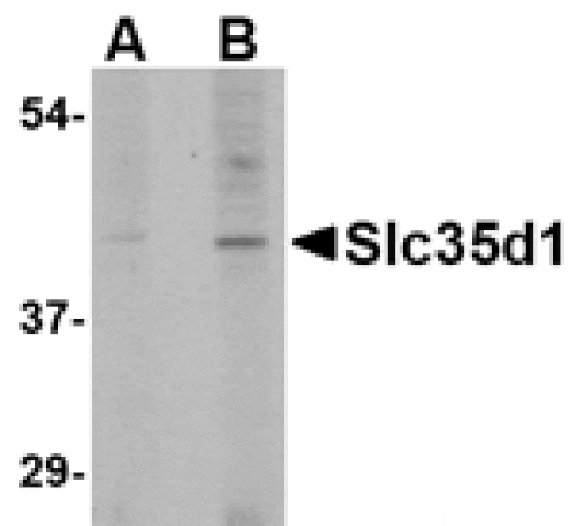 Western blot - Slc35D1 Antibody from Signalway Antibody (24684) - Antibodies.com