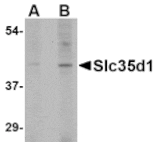 Western blot - Slc35D1 Antibody from Signalway Antibody (24684) - Antibodies.com