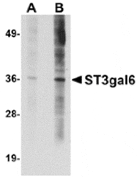Western blot - ST3gal6 Antibody from Signalway Antibody (24896) - Antibodies.com