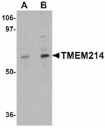 Western blot - TMEM214 Antibody from Signalway Antibody (24946) - Antibodies.com
