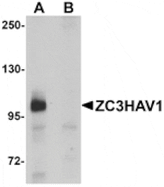 Western blot - ZC3HAV1 Antibody from Signalway Antibody (25151) - Antibodies.com