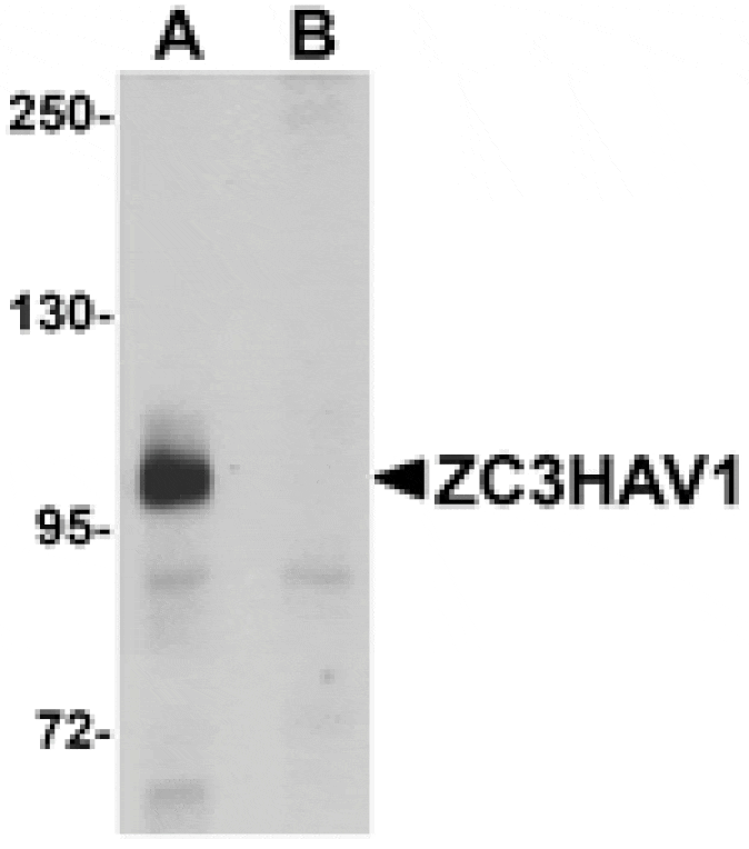 Western blot - ZC3HAV1 Antibody from Signalway Antibody (25151) - Antibodies.com