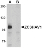 Western blot - ZC3HAV1 Antibody from Signalway Antibody (25151) - Antibodies.com